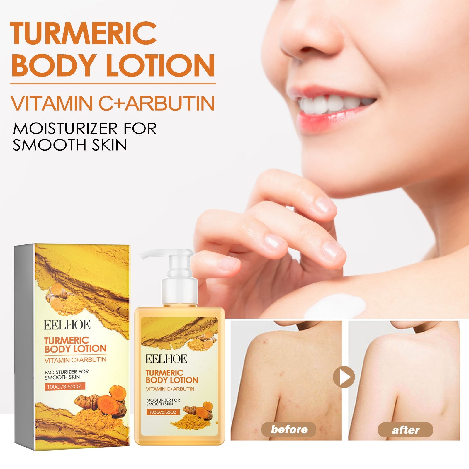 Turmeric Body Lotion, Moisturizing And Moisturizing Whitening Skin Refreshing And Brightening Winter Skin Care Body Lotion