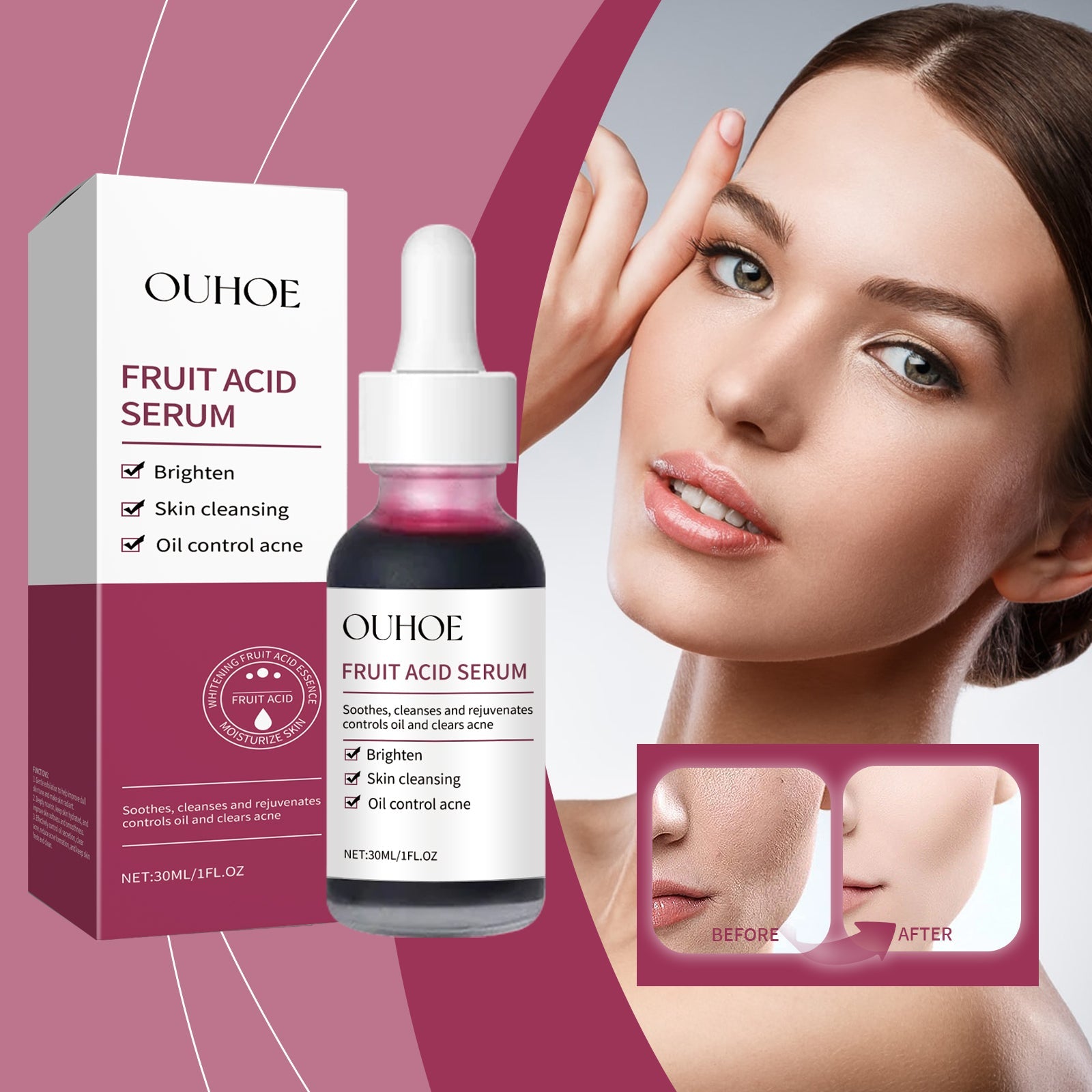 Fruit Acid Purifying Essence, Gentle Exfoliating, Moisturizing And Moisturizing Daily Skin Care Essence