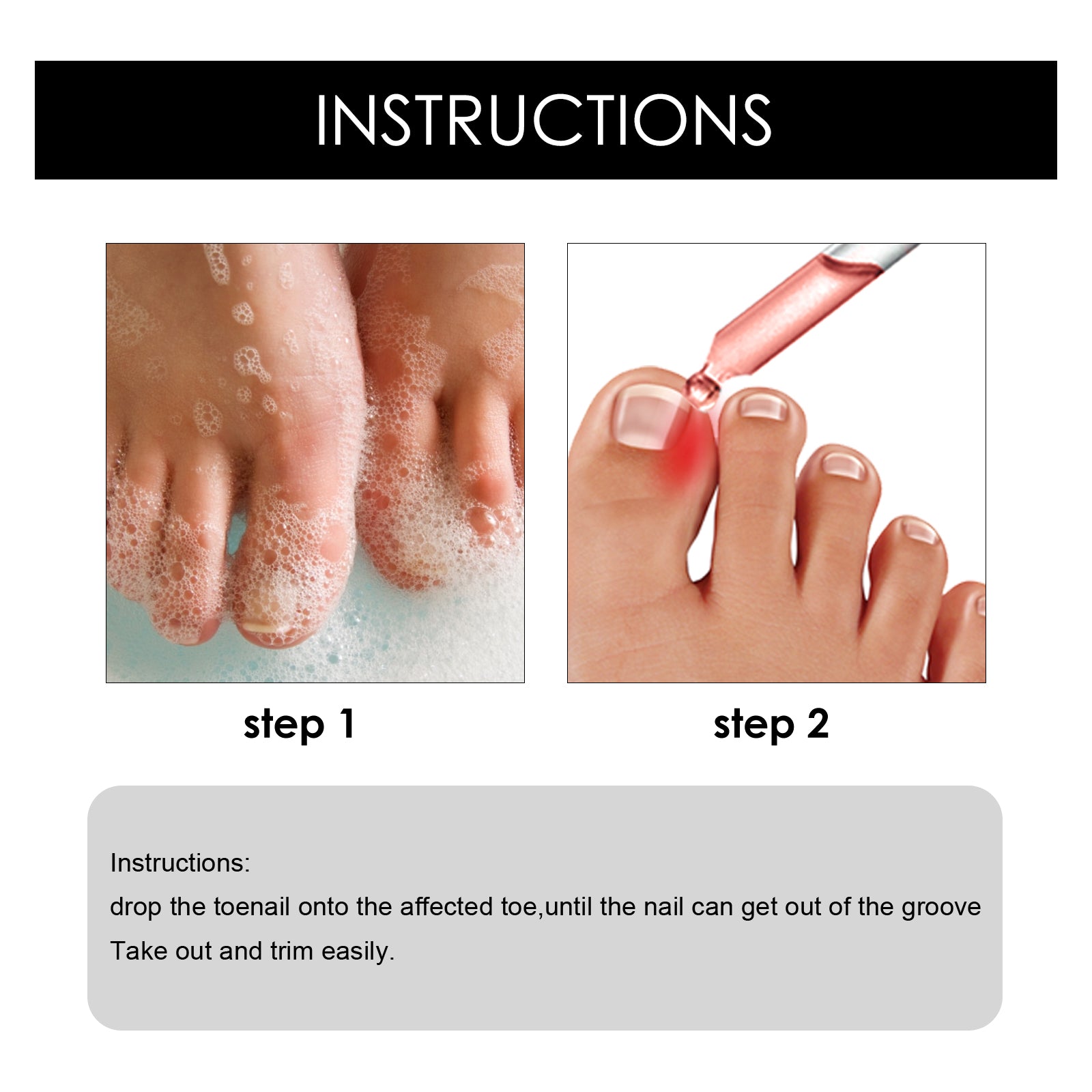 Toenail Repair Essence Moisturizes, Restores And Cleanses Foot Nails And Brightens With Essential Oil