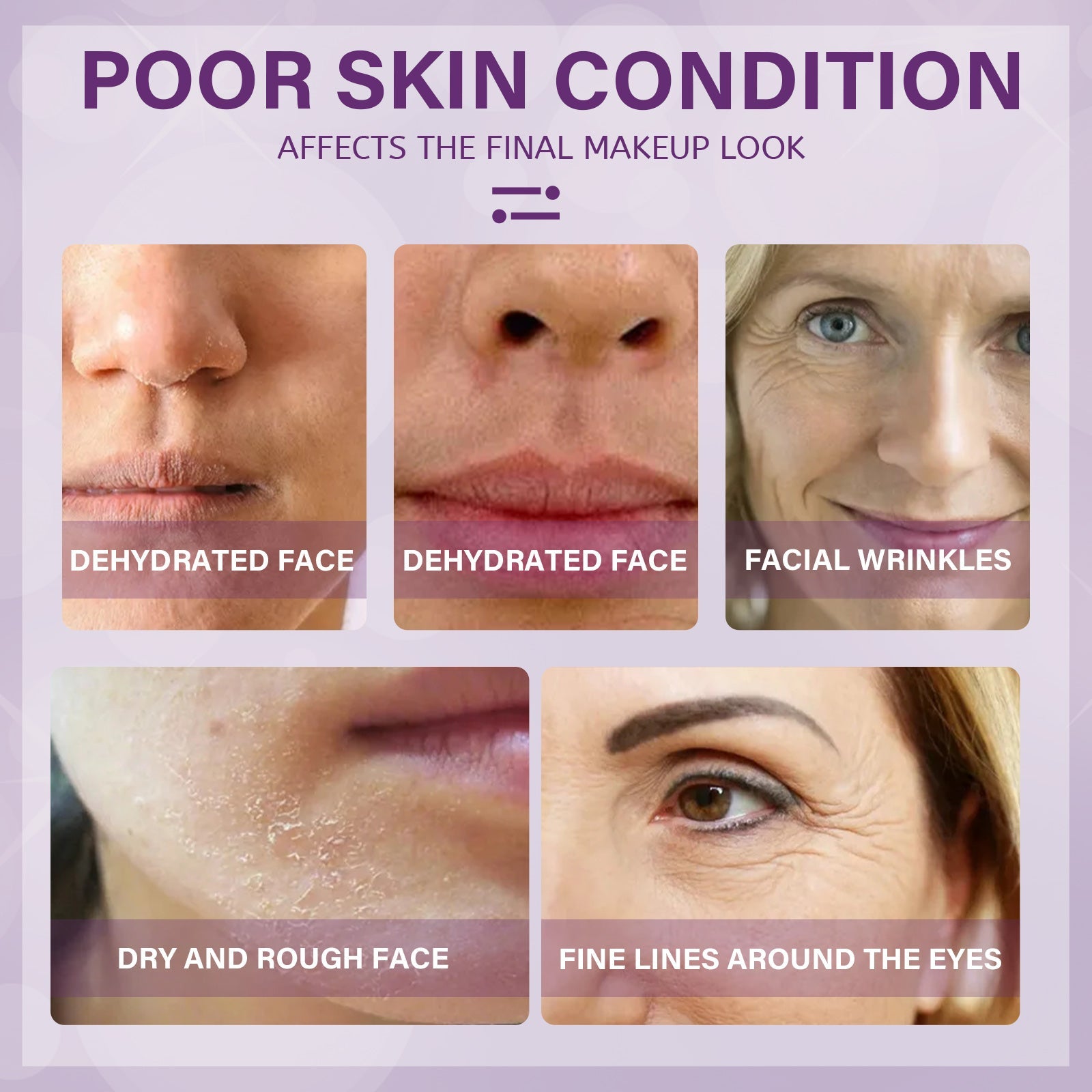 Moisturizer Improves Dry Skin Cream Tightens And Lightens Wrinkles Hydrating Moisturizing Moisture Easy To Absorb