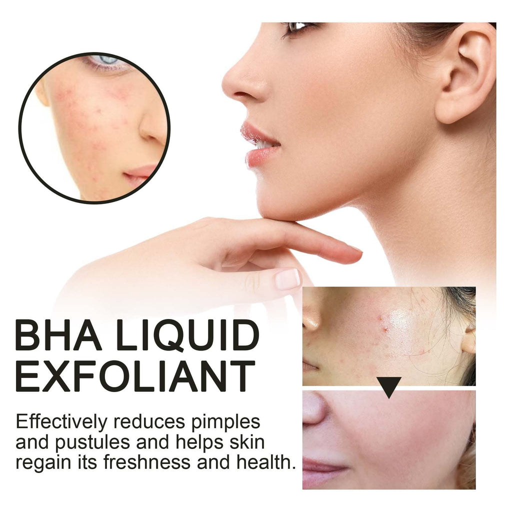 BHA Liquid Exfoliant, Lightening Acne Seal Pore-Tightening And Moisturizing Skin Essence