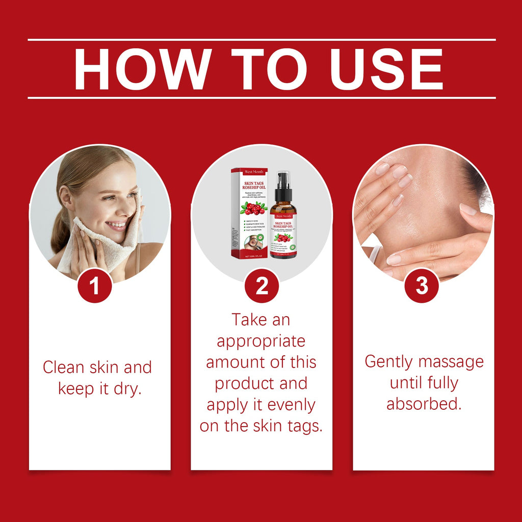 Rosehip Seed And Wart Essence Oil, Moisturizes And Restores Smooth Skin