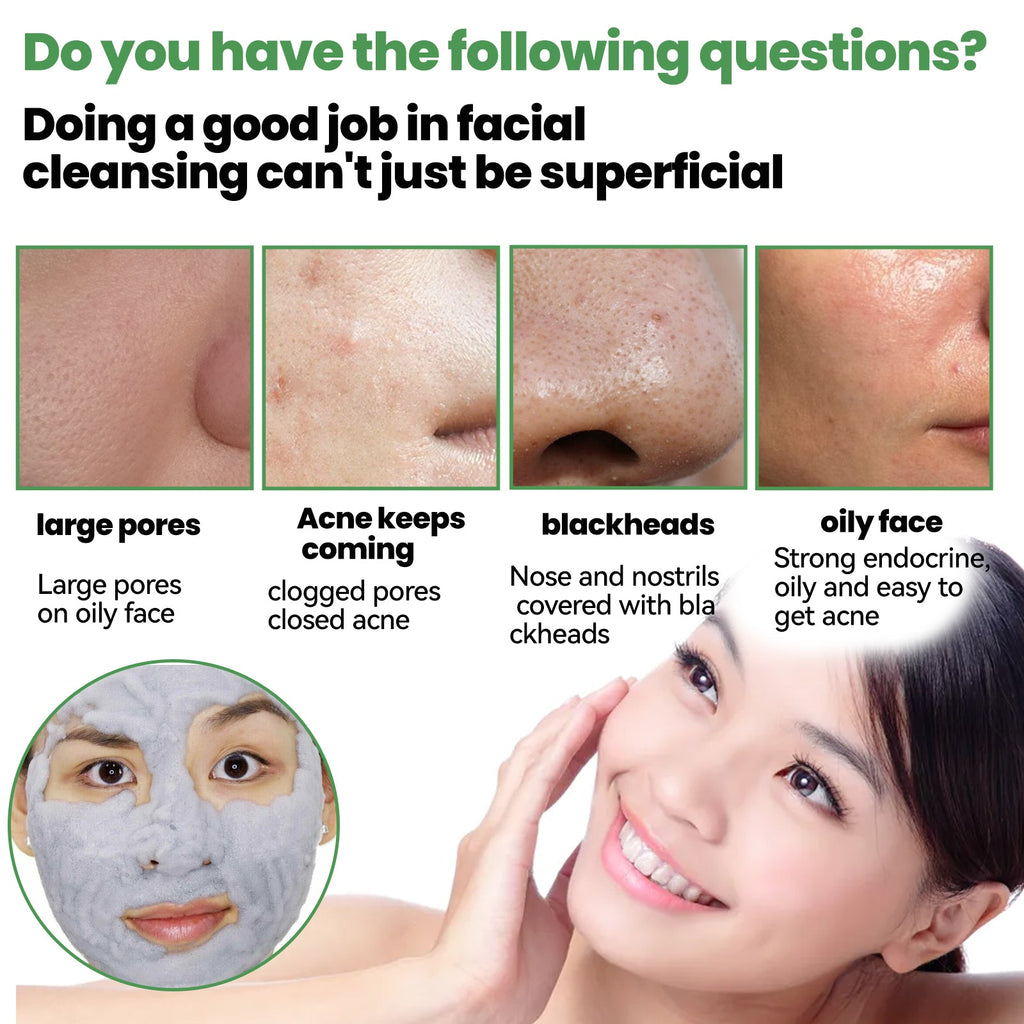 Clean And Apply Bubble Mask, Moisturizing Apply Removing Blackhead And Pimple Oxygen Cleansing Mud Mask