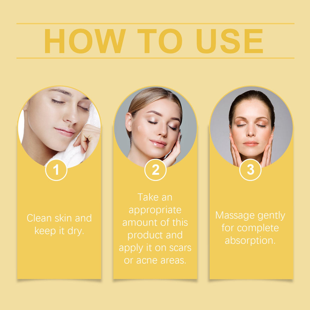 Acne-Clearing Gel, Deep Cleansing Facial Skin Brightening And Concealer Treatment Gel For Acne Reduction