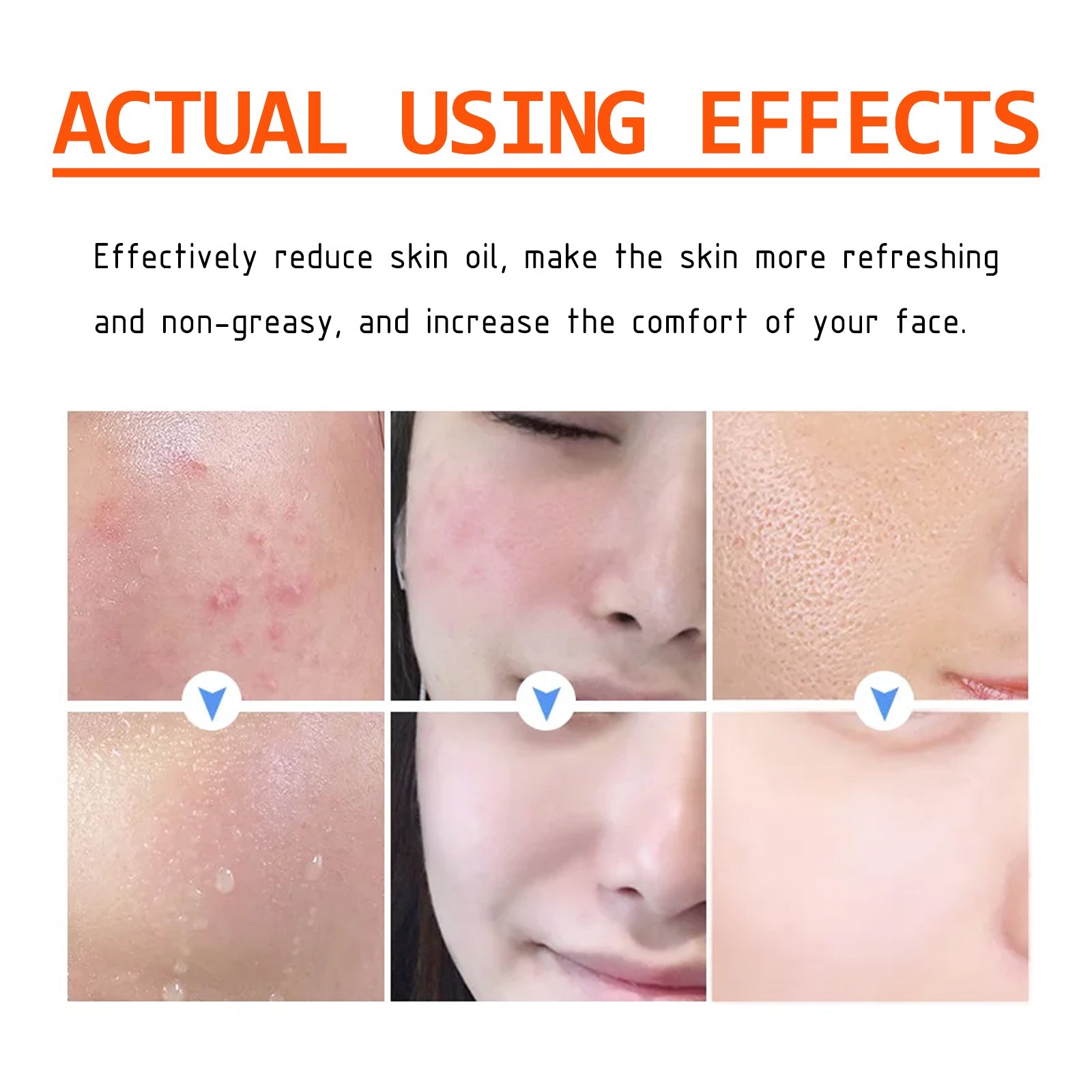 Salicylic Acid Facial Mask Gentle Cleansing Mask To Lighten Acne, Seal And Tighten Pores
