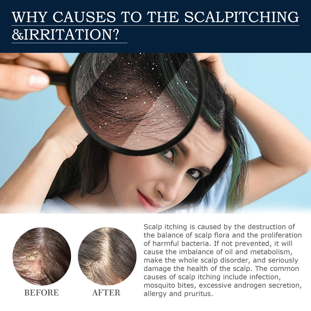 Scalp Treatment Essence Spray, Hair Care And Repair Damaged Hair Follicle Hair Root Treatment Spray
