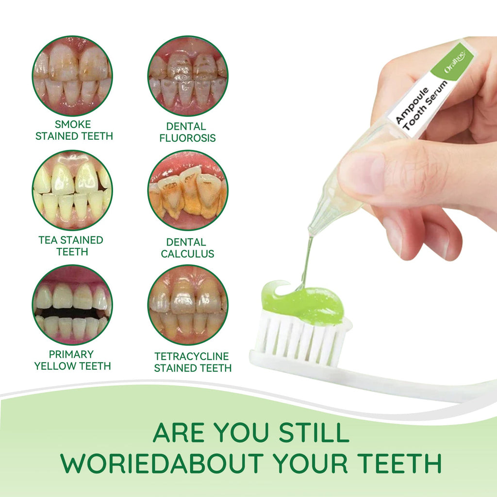 Teeth Whitening Serum, Deep Cleaning Mouth Stains Yellow Care Teeth Whitening Teeth
