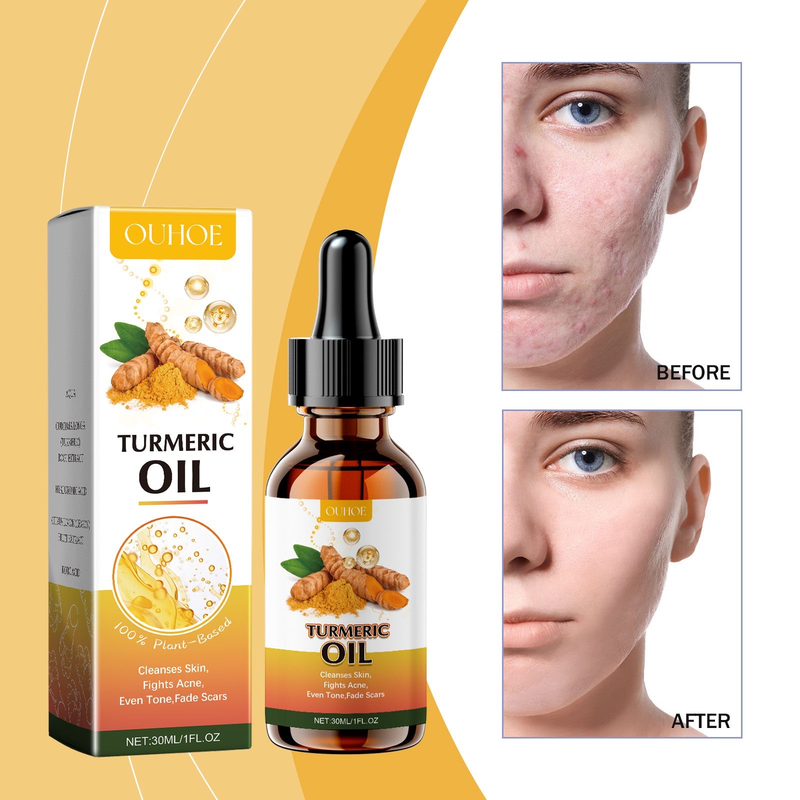 Ouhoe Cleansing Turmeric Oil Gently Cleanses And Moisturizes Facial Skin, Brightening And Whitening Skin With A Refreshing Cleansing Oil