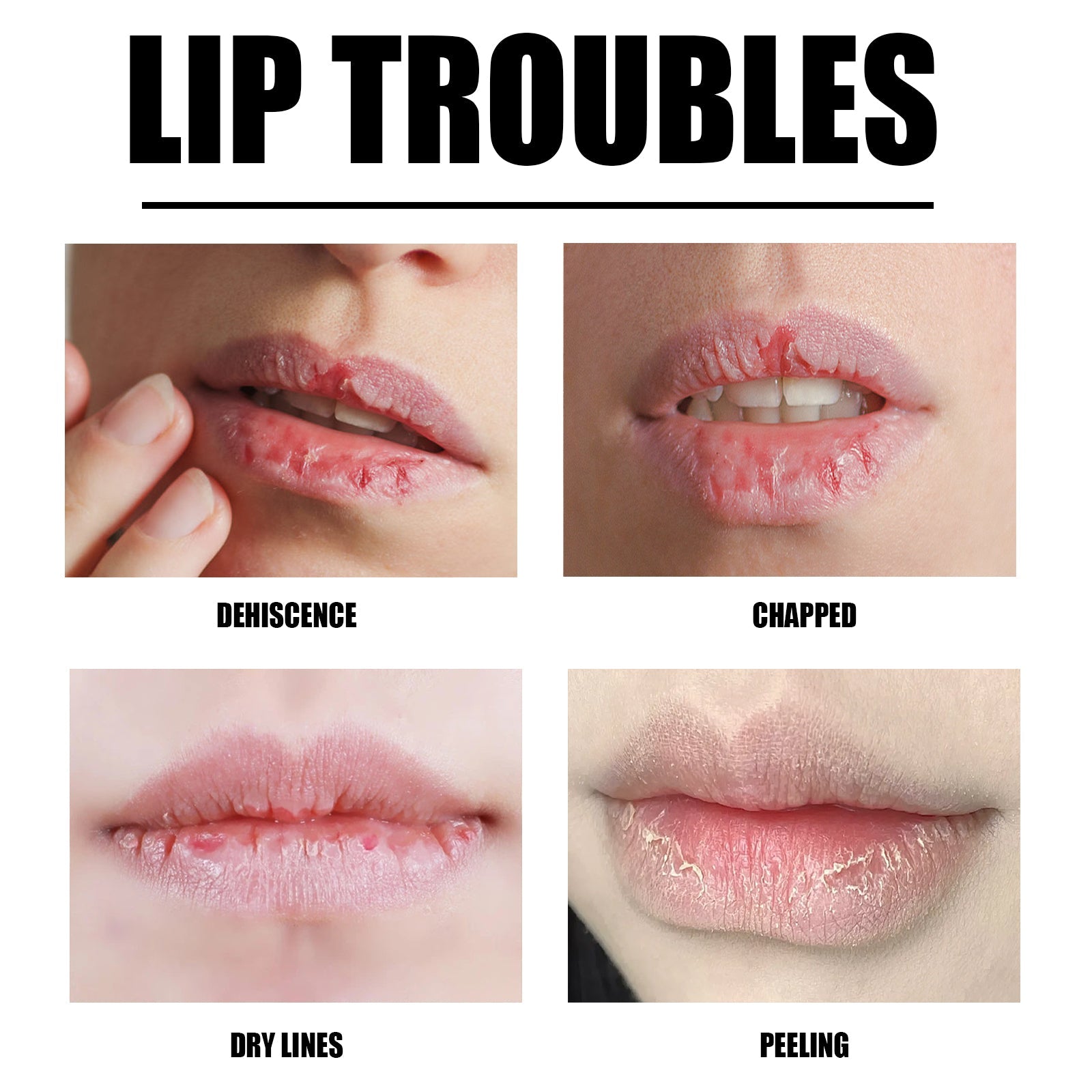 Lip Scrub, Lip Wrinkles Dry Dead Skin Moisturizing Toot Lips Moist Lips Lip Care