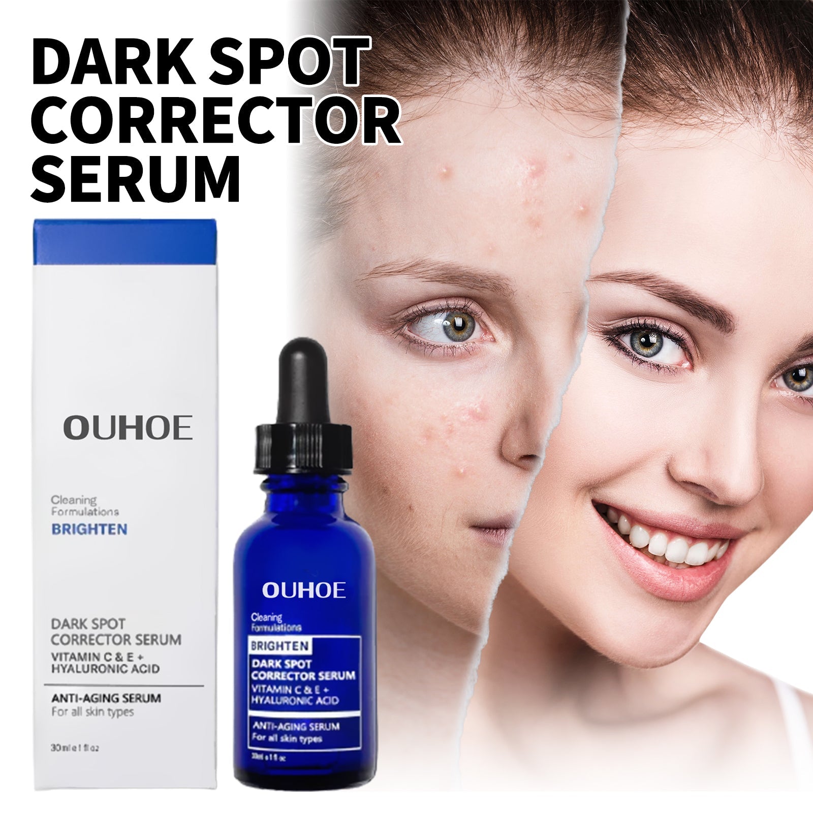 Dark Spot Repair Essence, Repair Acne Pimple Lightening Spot Fine Lines Moisturizing Firming Whitening Essence
