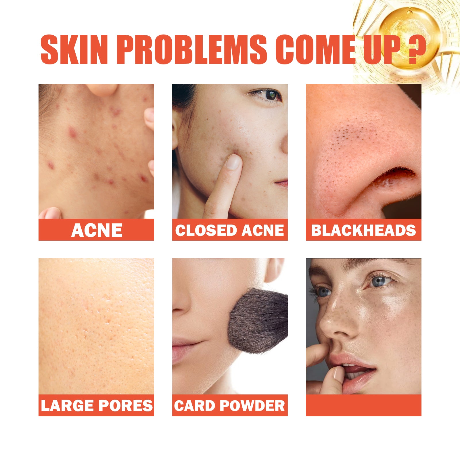 Snail Nourishing Repair Essence, Lightening Acne Muscle Acne Mark, Hydrating Whitening And Eliminate Pimples Essence