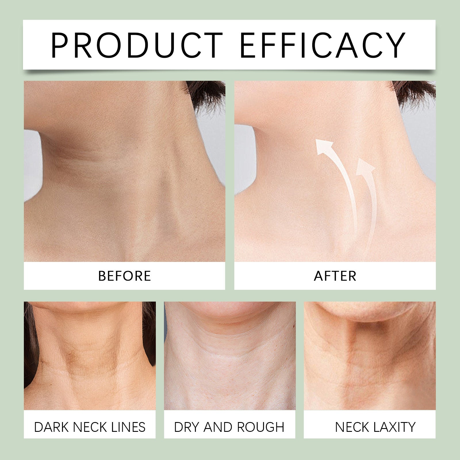 Lines Gone Neck Gel, Neck Moisturizer Improves Neck Lines And Moisturizes Skin Hydrating Gel