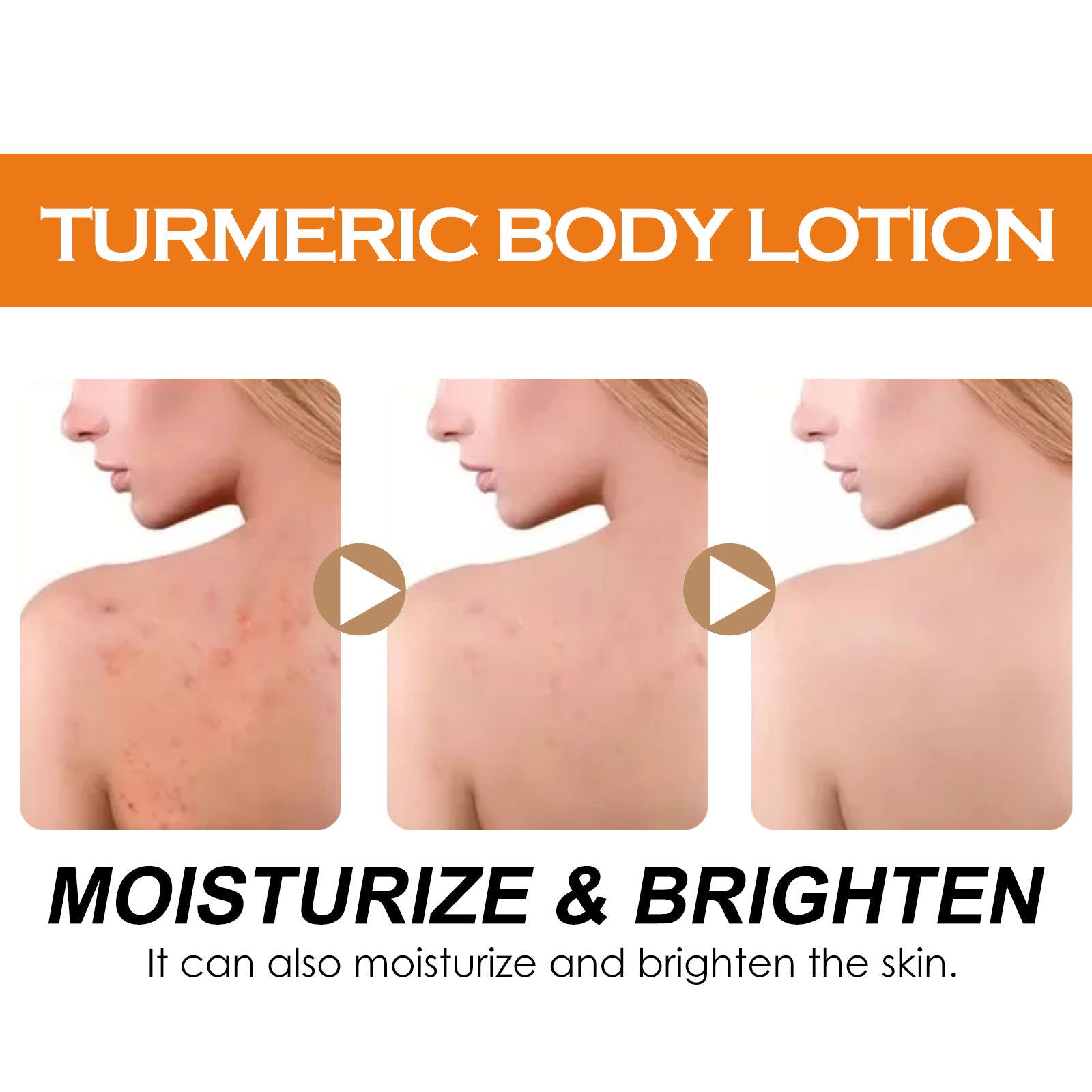 Turmeric Body Lotion, Moisturizing And Moisturizing Whitening Skin Refreshing And Brightening Winter Skin Care Body Lotion