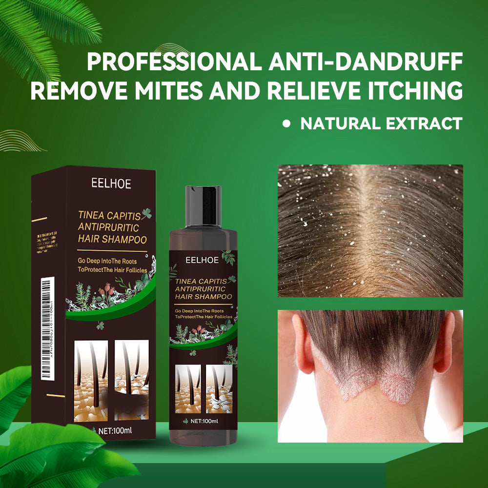 Tinea Capitis Anti-Itch Shampoo Anti-Drop Refreshing Oil Control Hair Care Anti-Dandruff Anti-Itch Shampoo