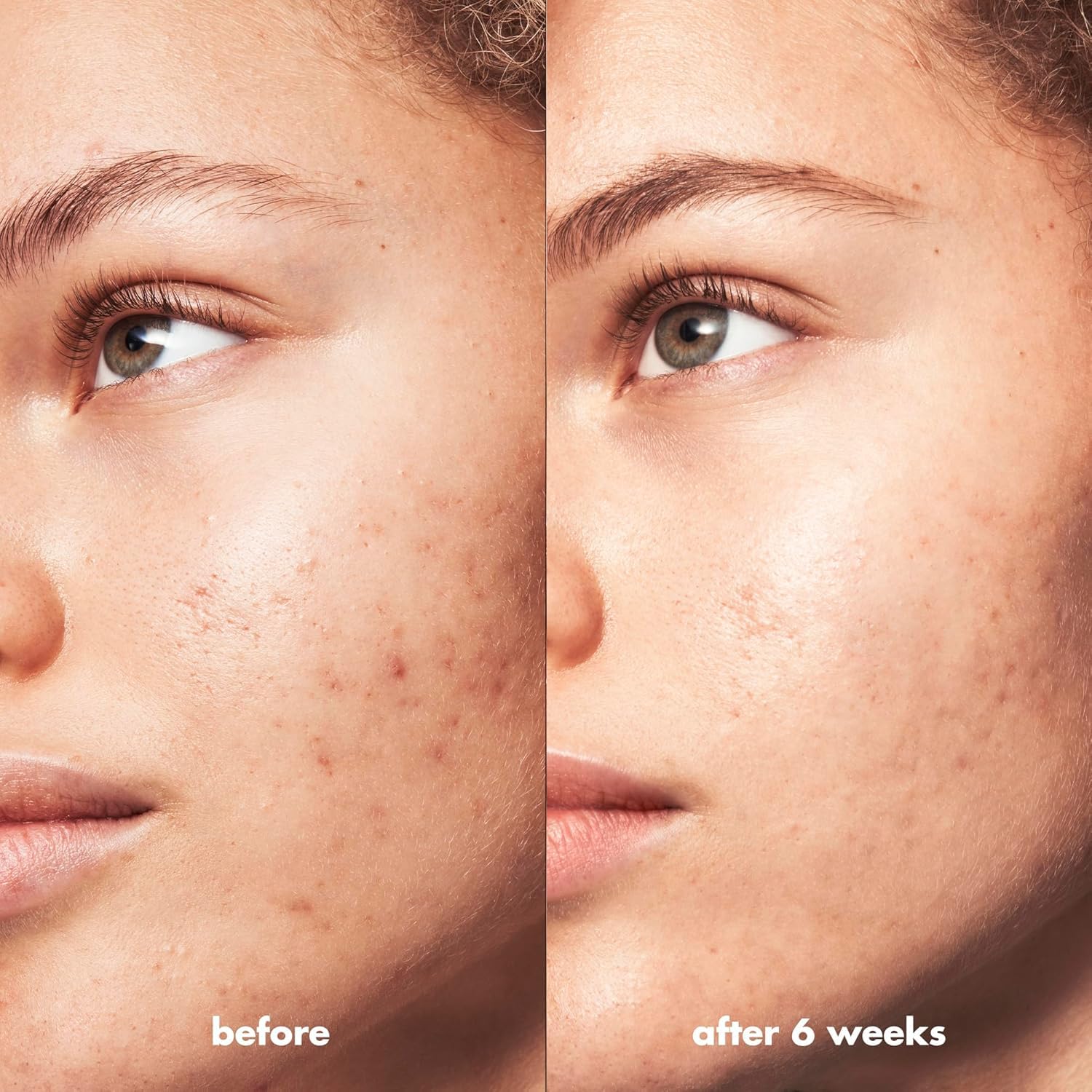 e.l.f SKIN Blemish Breakthrough Calming Water Cream