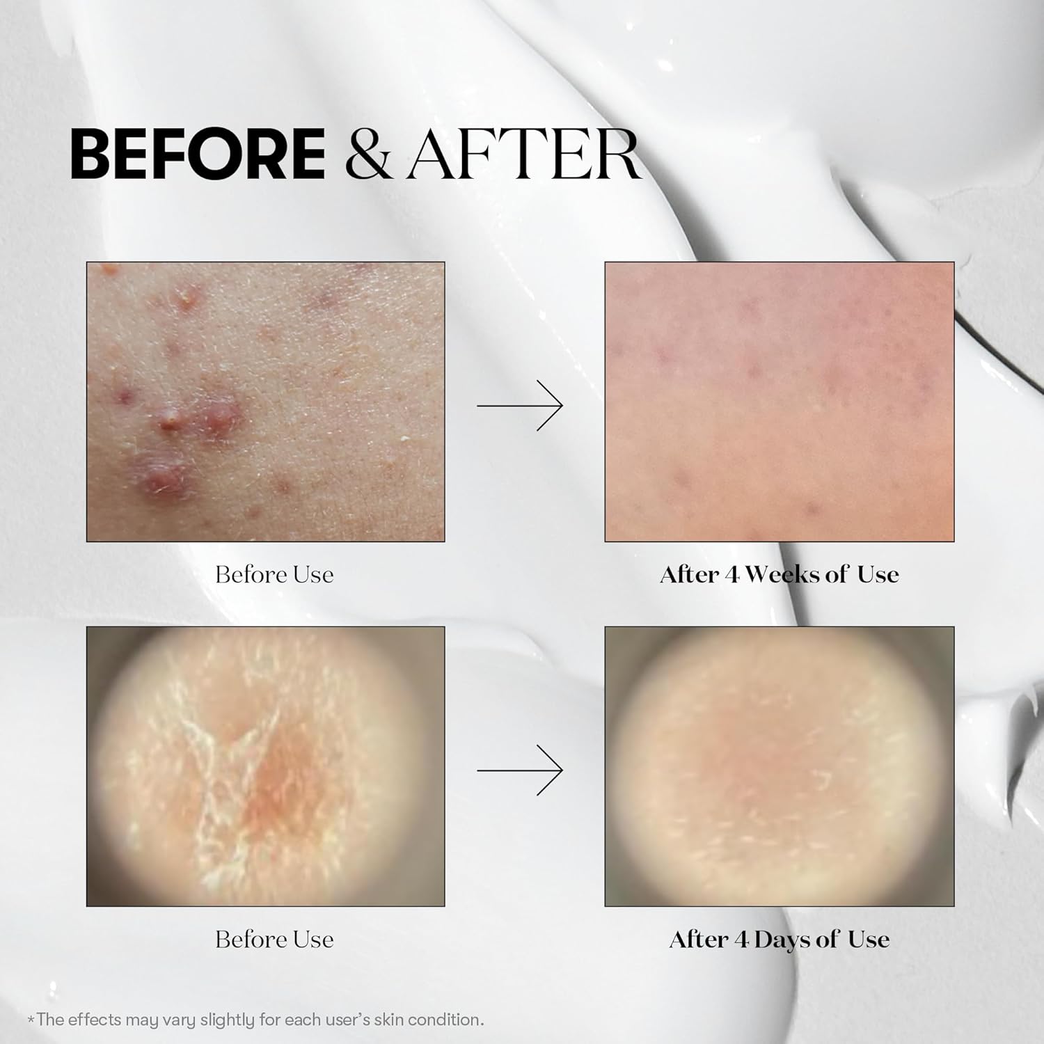 VT Cosmetic Revitalizing & Youth-Looking Reedle Shot