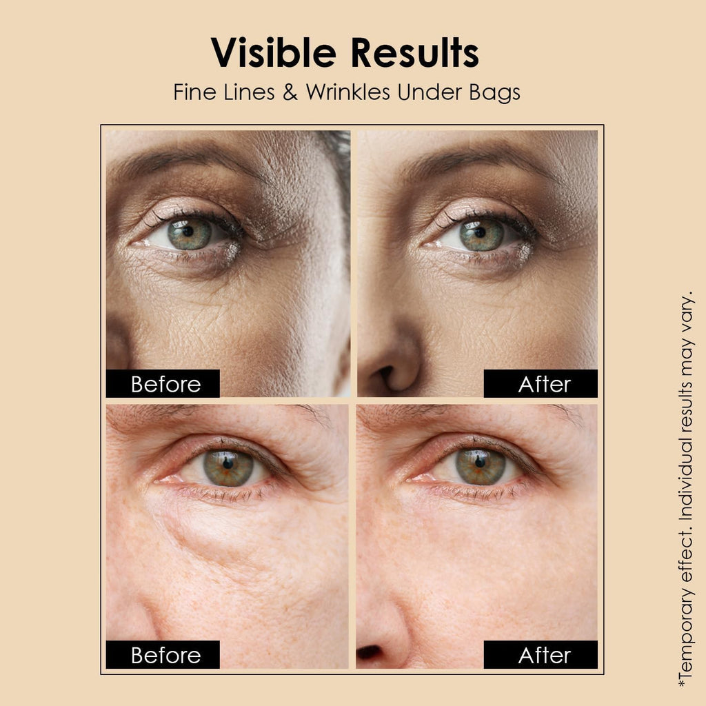 MEOLY Instant Eye Fix Cream