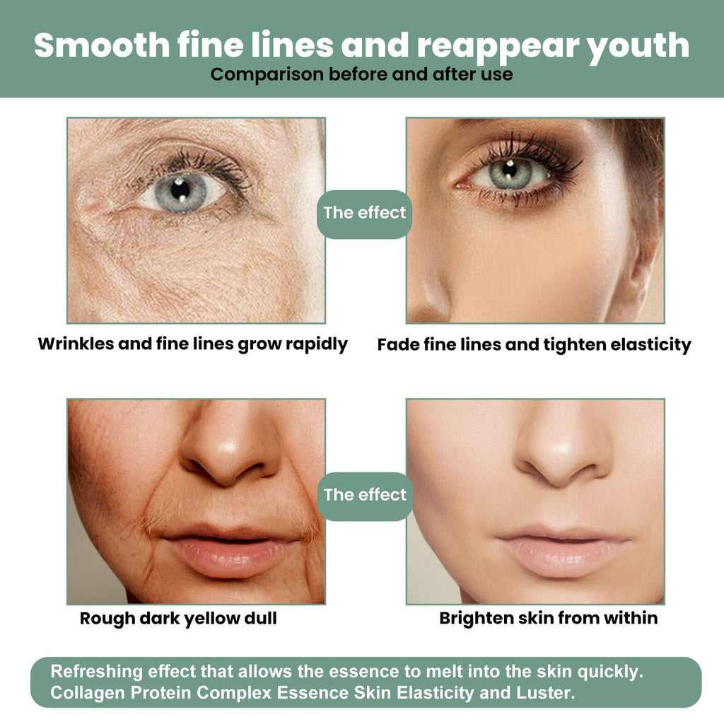 Collagen Anti-Aging Serum, Hydrates Reduces Fine Lines And Firming Skin Care Essence