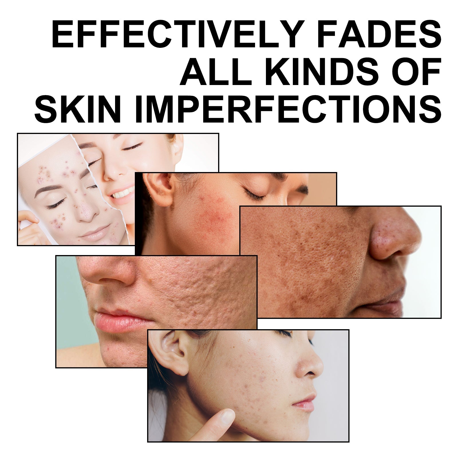Multi Function Face Serum, Moisturize And Soften Fine Lines And Wrinkles