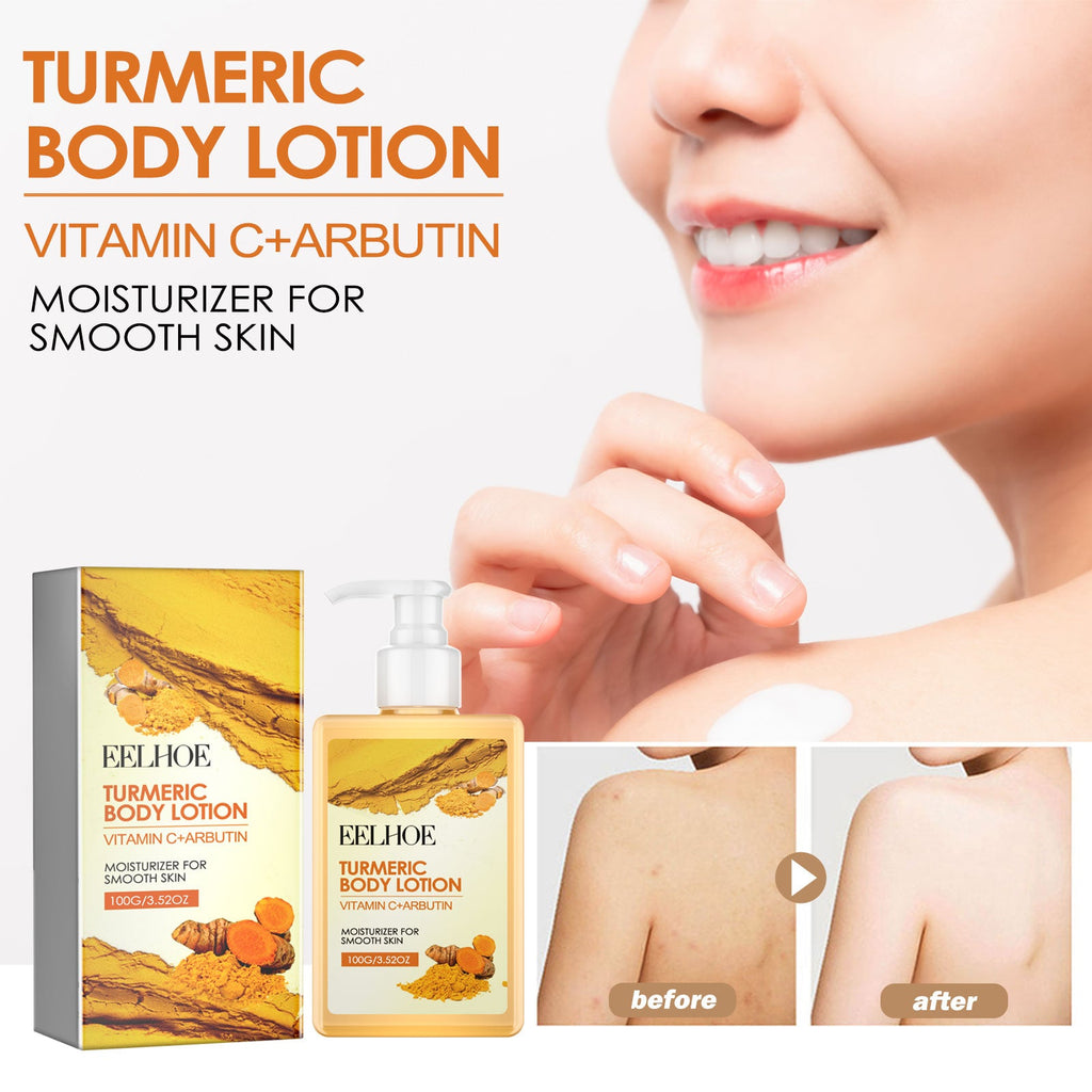 Turmeric Body Lotion, Moisturizing And Moisturizing Whitening Skin Refreshing And Brightening Winter Skin Care Body Lotion