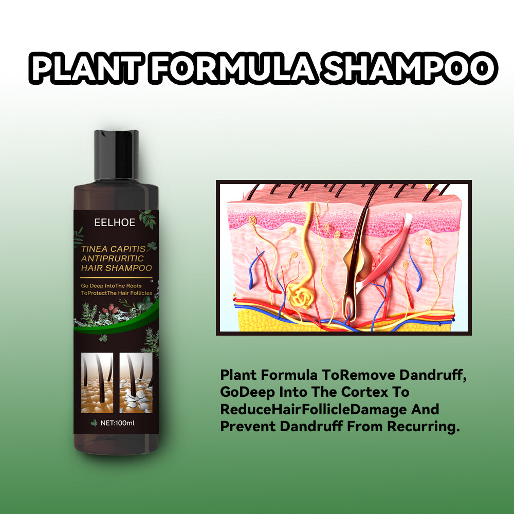 Tinea Capitis Anti-Itch Shampoo Anti-Drop Refreshing Oil Control Hair Care Anti-Dandruff Anti-Itch Shampoo