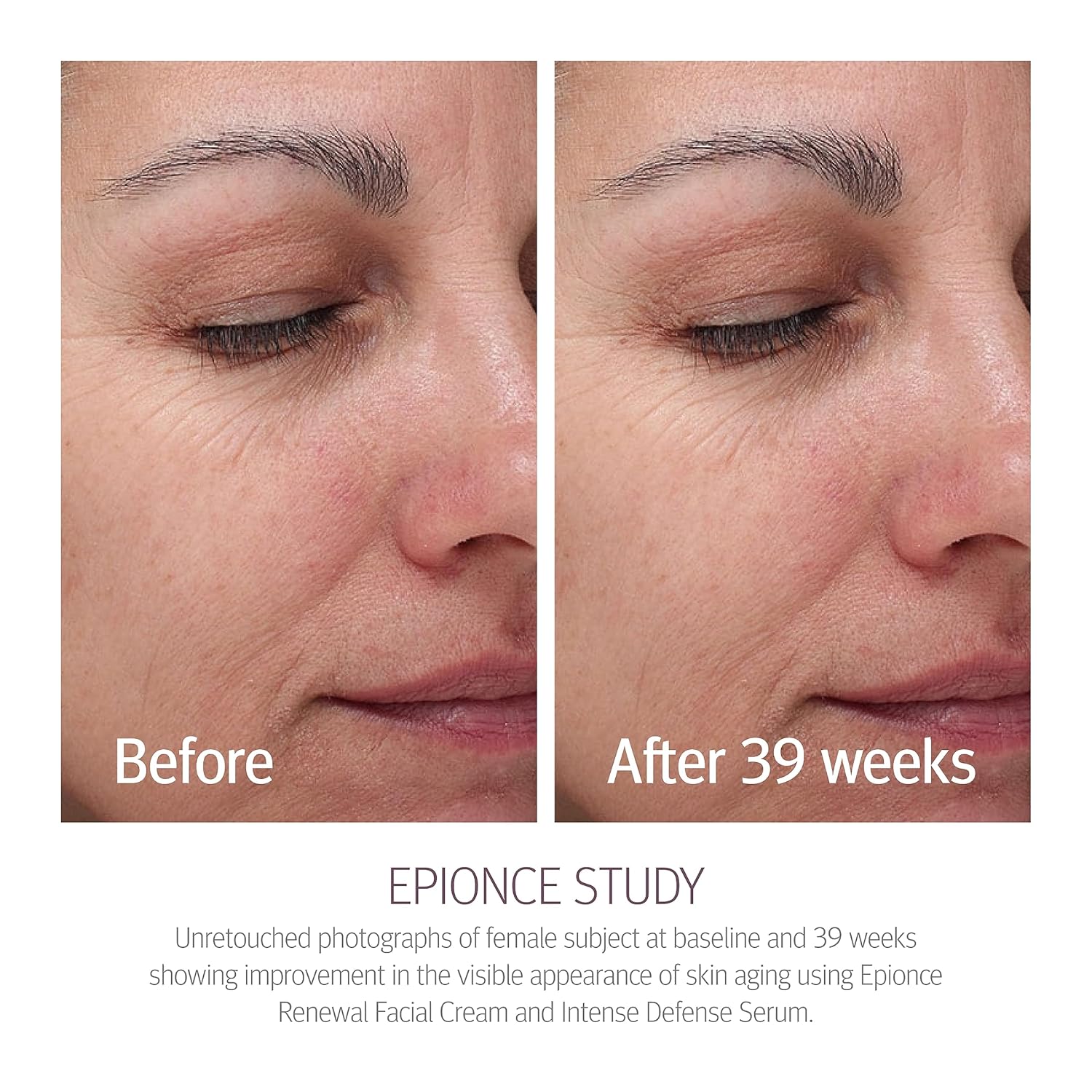 EPIONCE Renewal Facial Cream