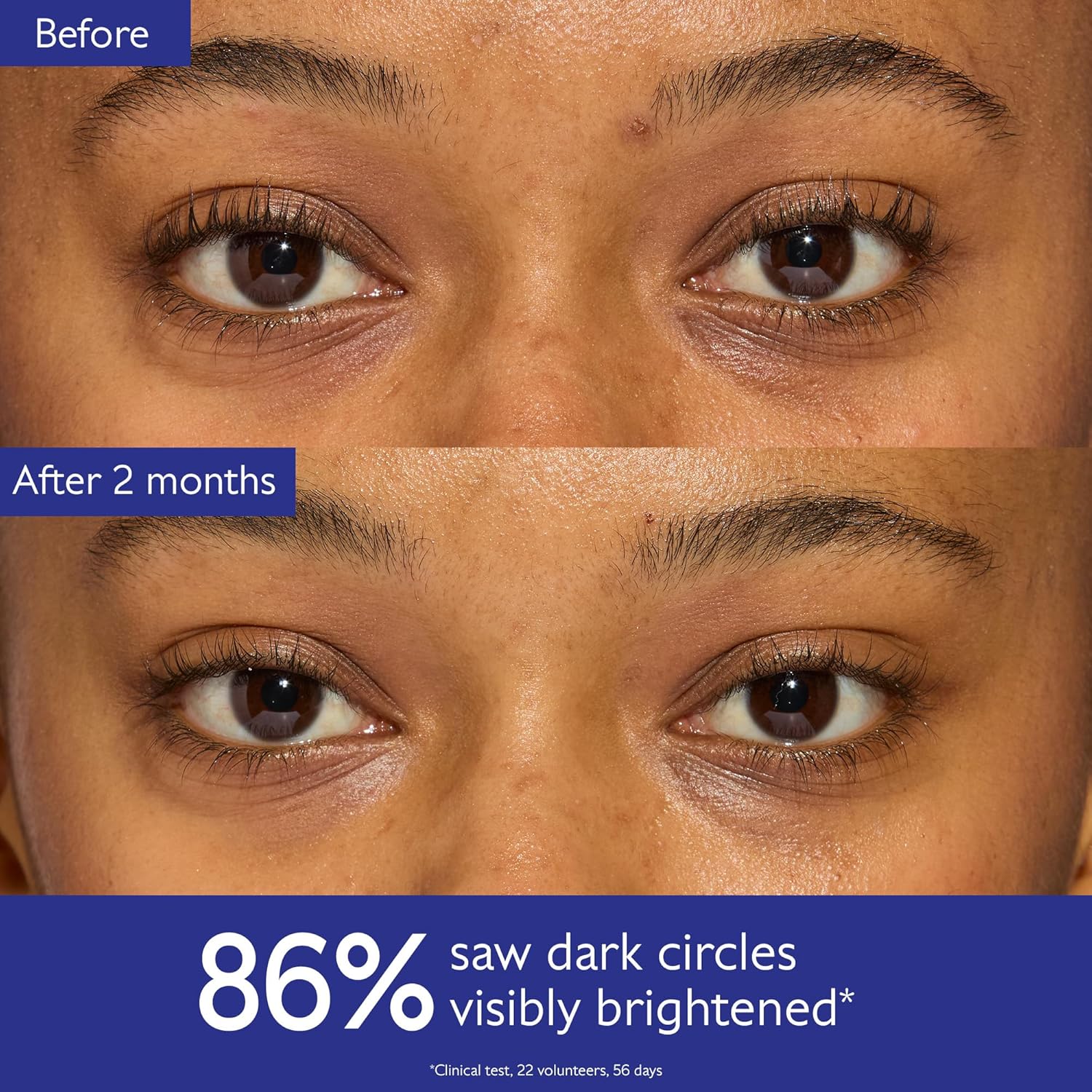 CAUDALIE Vinoperfect Brightening Eye Cream