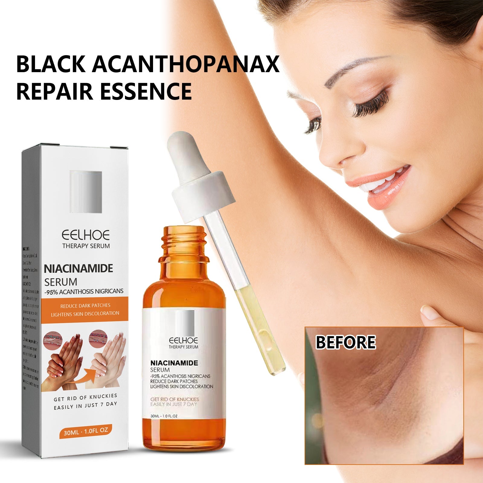 Acanthosis Nigricans Repair Essence, Brightening Skin Repair Skin Beauty Essence Underarm Joint Black Whitening