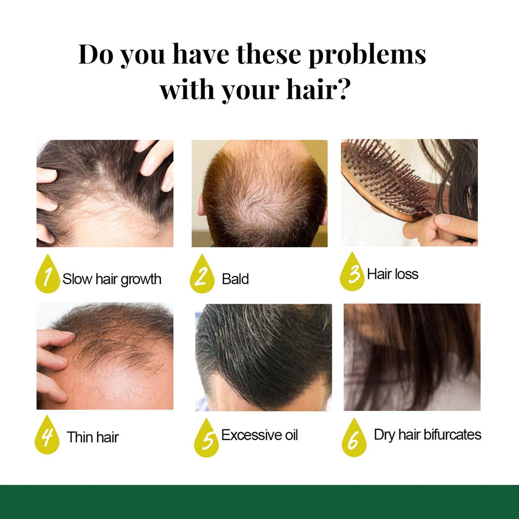 Ginger Hair Spray, Strengthens Hair, Massages Scalp And Restores Hair