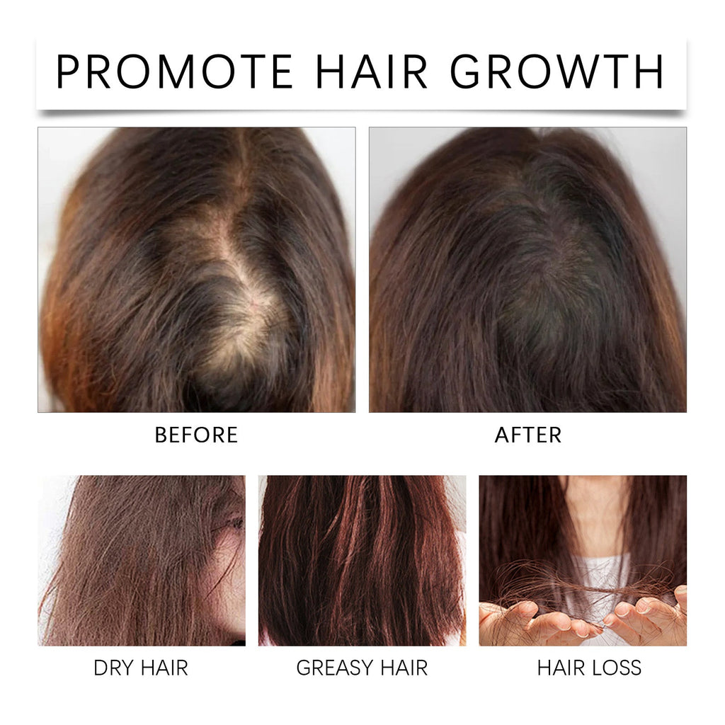 Palm Oil Hair Care Essence, Scalp Massage Treatment Repair Dry Hair, Soft And Solid Hair