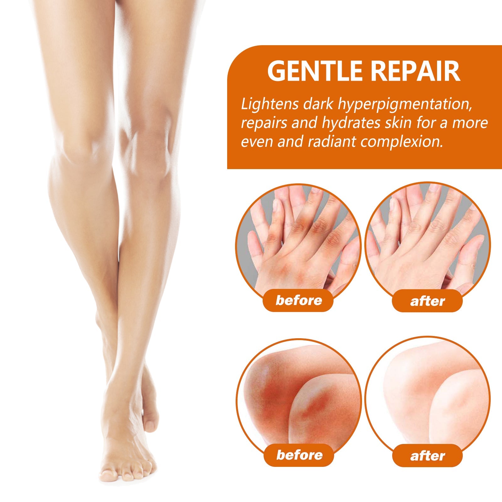 Acanthosis Nigricans Repair Essence, Brightening Skin Repair Skin Beauty Essence Underarm Joint Black Whitening