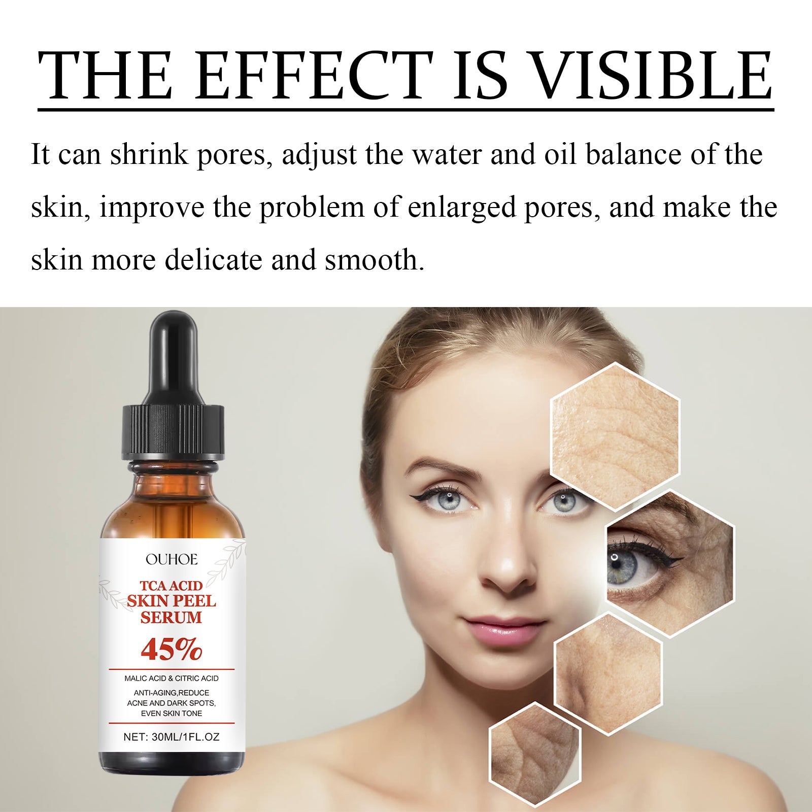 TCA Acid Skin Peel Serum