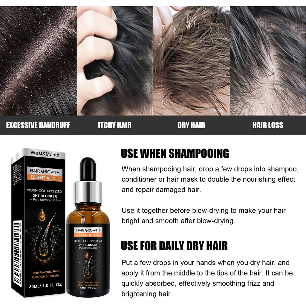 Hair Growth Essential Oil, Dense Hair Growth Repair Dry Hair And Moisture Hair Essence