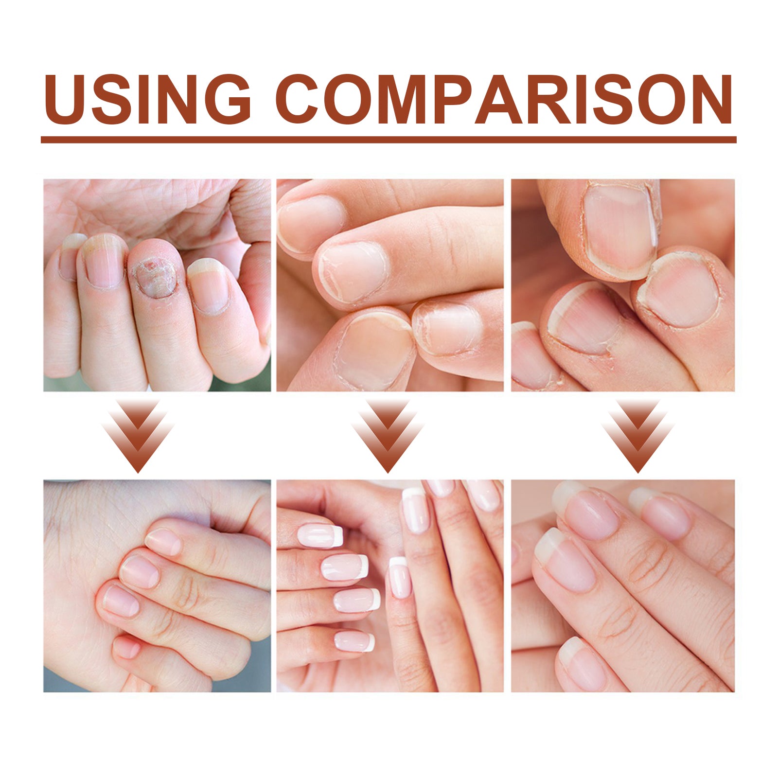 7 Day Nail Care Essence Grey Nail, Hand, Foot And Nail Nourishing Cleansing Essence
