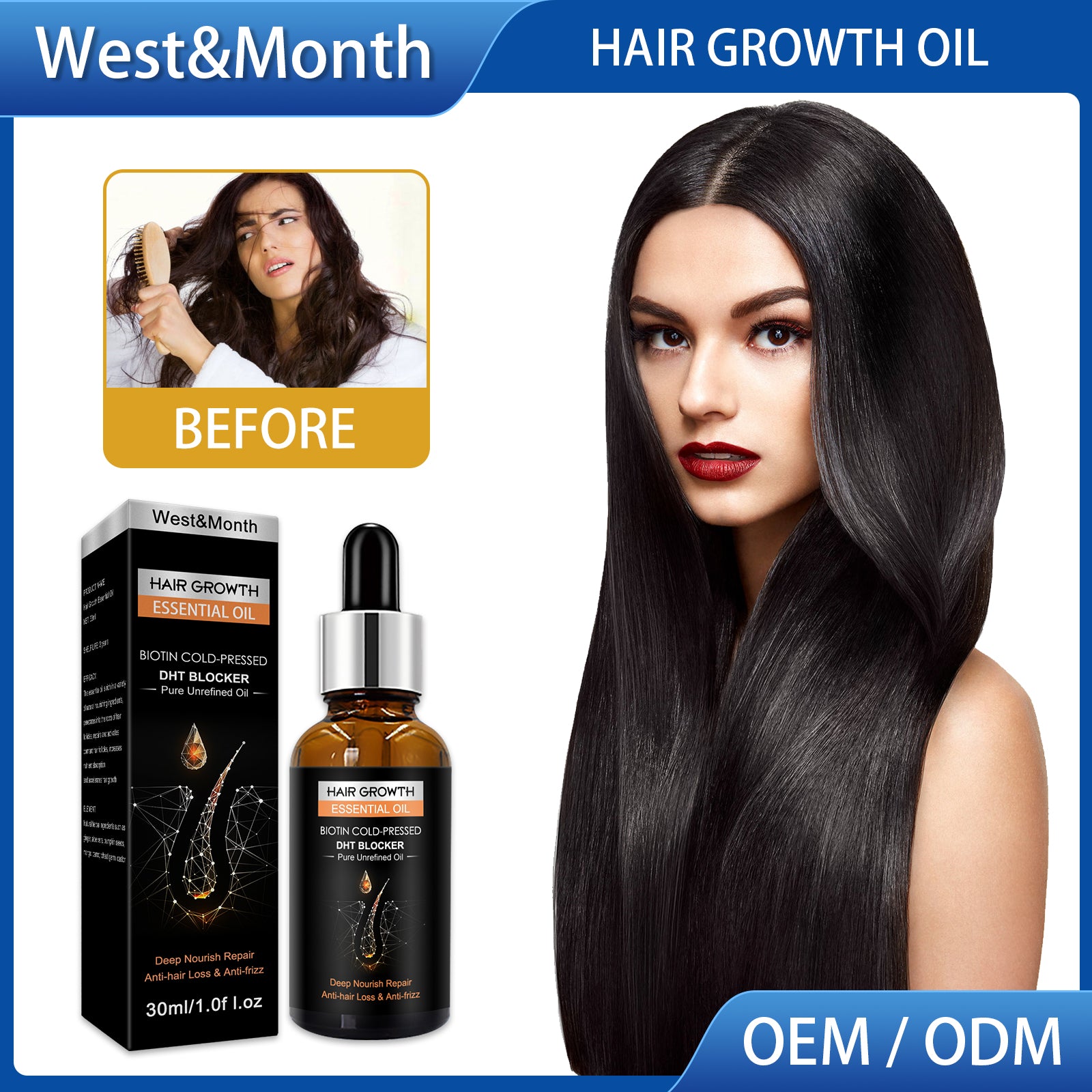 Hair Growth Essential Oil, Dense Hair Growth Repair Dry Hair And Moisture Hair Essence