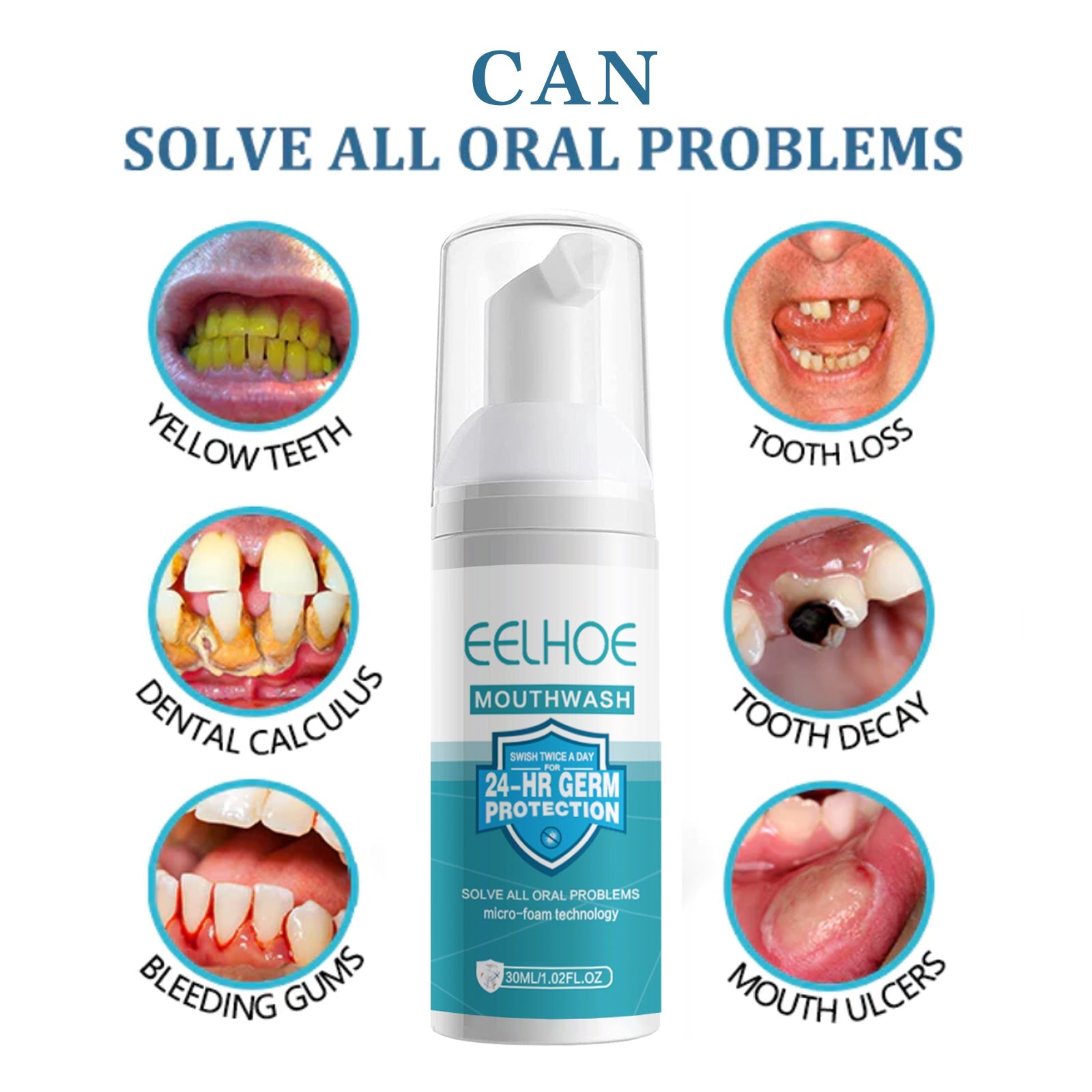 Dental Cleanser Mousse Anti-Decay Yellow Teeth Clean Smoke Stains And Tartar Fresh Breath Press Clean Teeth