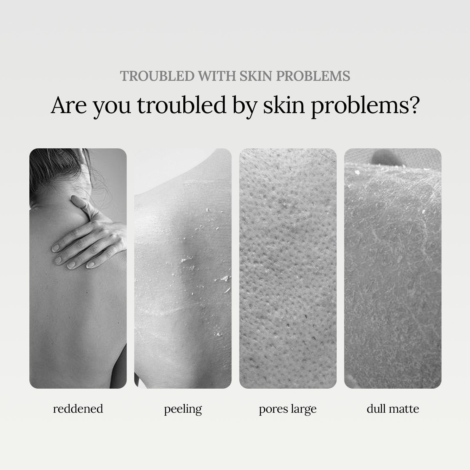 Niacinamide Scented Shower Gel, Body Cleans Corneous Brighten Skin Tone Delicate Pore Moisturize Repair