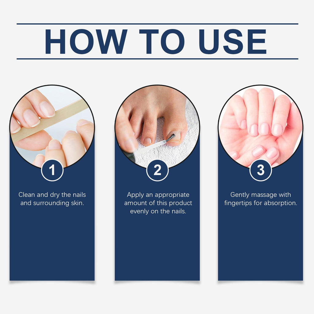 Nail Repair Essence Moisturizes Nails, Strengthens Nails, Cleans Gray Nails, Restores Nails And Nourishes Nails