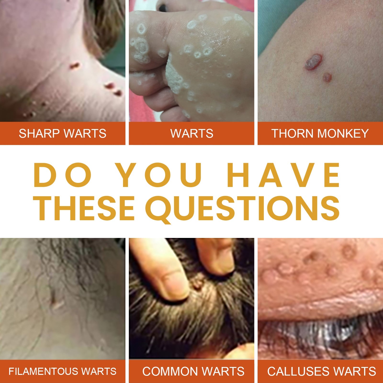 Anti-wart Essence, Anti Warts Fade Moles Corns Smoothing Skin Care Essence