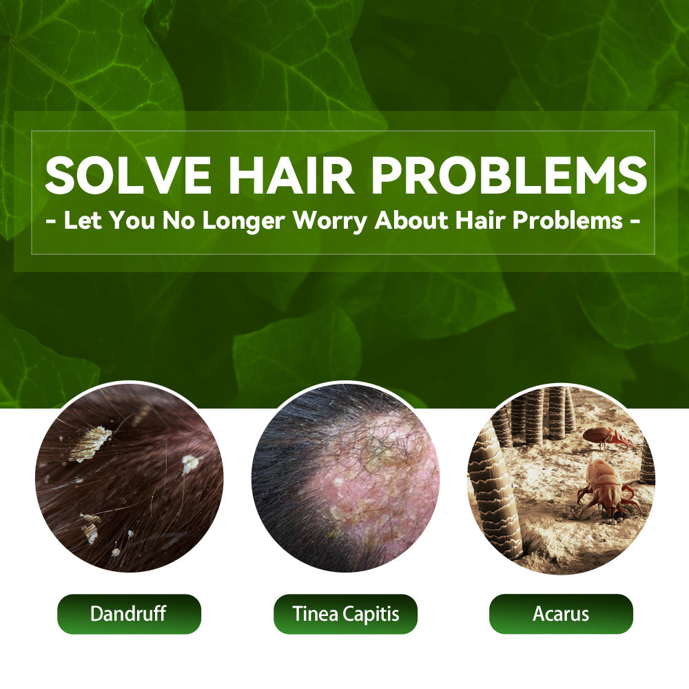 Tinea Capitis Anti-Itch Shampoo Anti-Drop Refreshing Oil Control Hair Care Anti-Dandruff Anti-Itch Shampoo