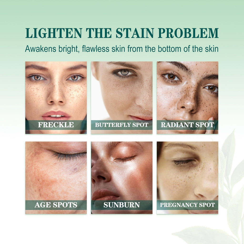 Brightening Blemish Essence, Lightening Melasma Blemish Hydrating And Brightening Skin Essence