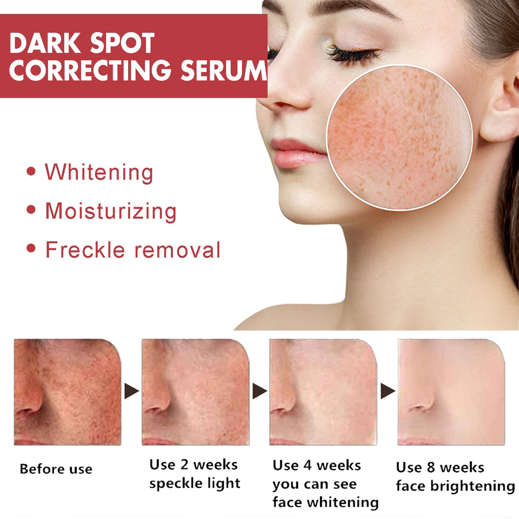 Dark Spots Repair Essence, Moisturizing And Brightening Repair Essence For Dark Spots And Age Spots