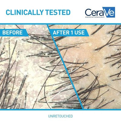 CeraVe Anti-Dandruff Scalp Care Shampoo 12 fl oz - Imperfect Container